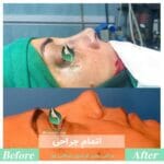 جراحی بینی ترمیمی-دکتر اسلامی جو