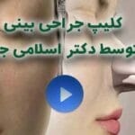 کلیپ جراحی بینی توسط دکتر اسلامی جو