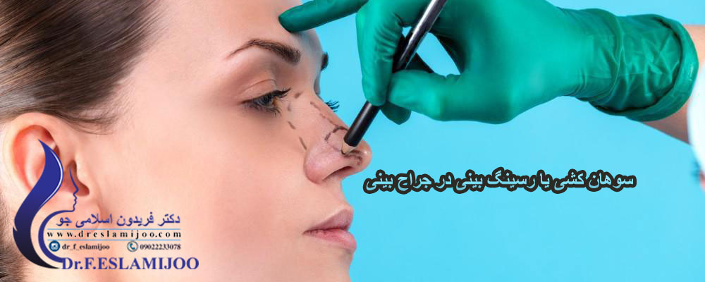 سوهان کشی یا رسینگ بینی در جراح بینی
